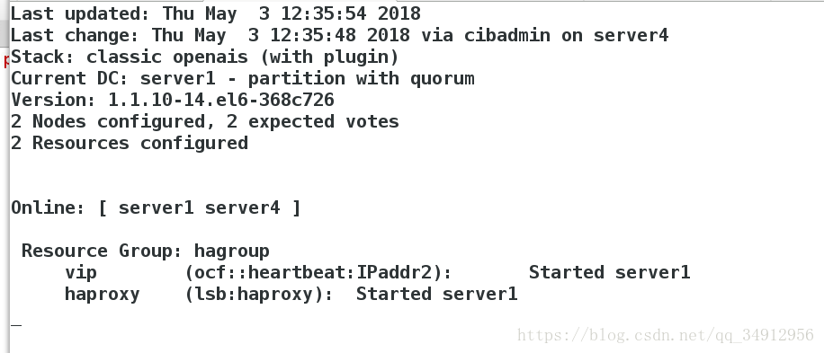pacemaker
